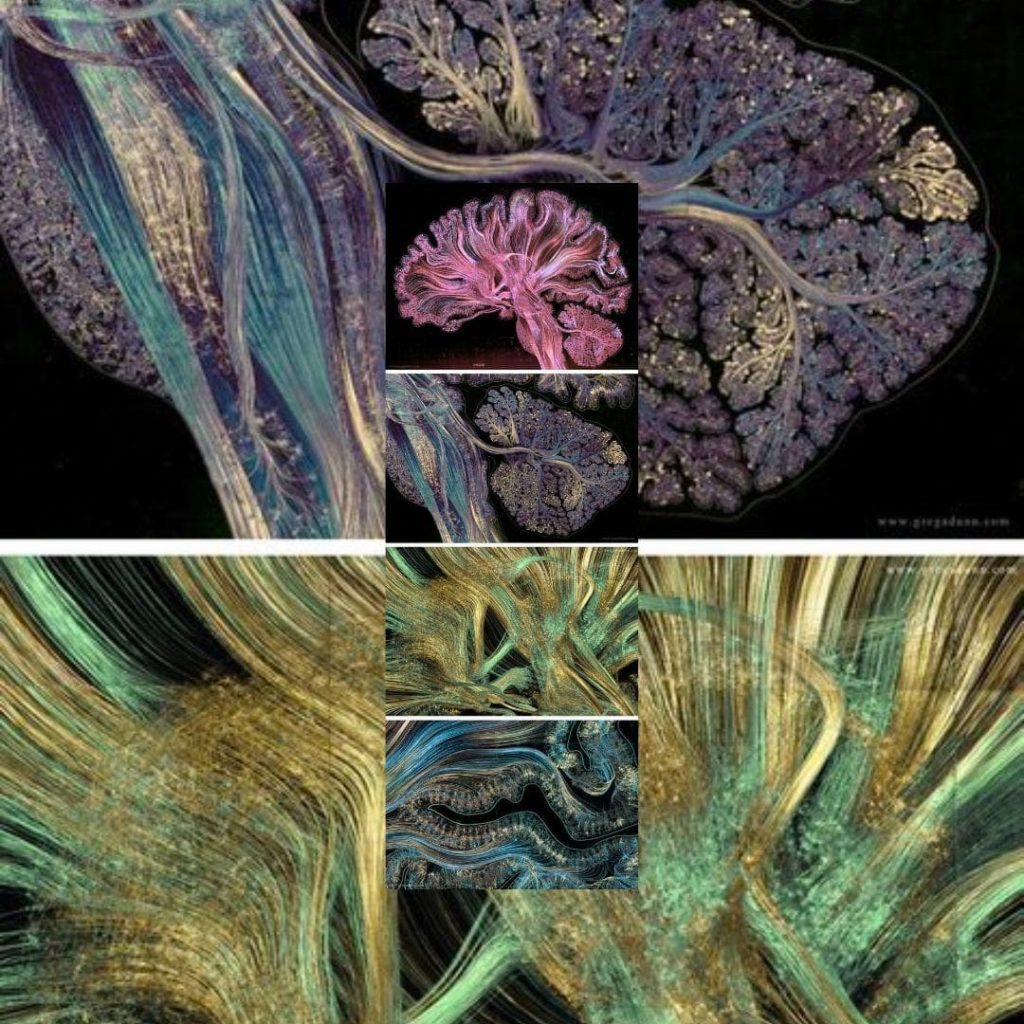 Neuroimaging by Dr. Greg Dunn and Dr. Brain Edwards